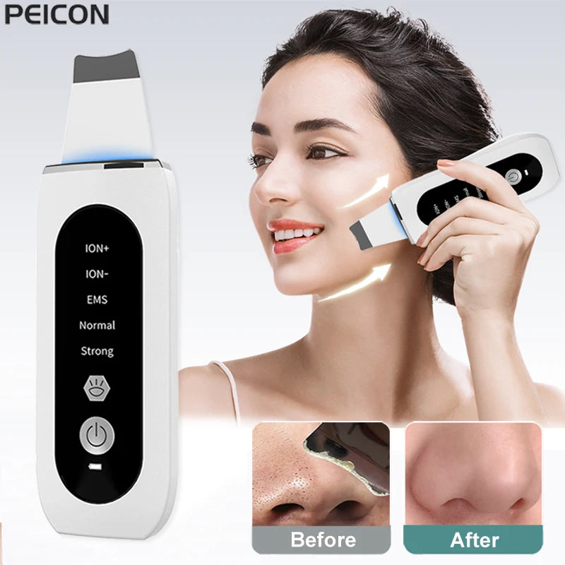 Ultrasonic Skin Scrubber Peeling Blackhead Remover