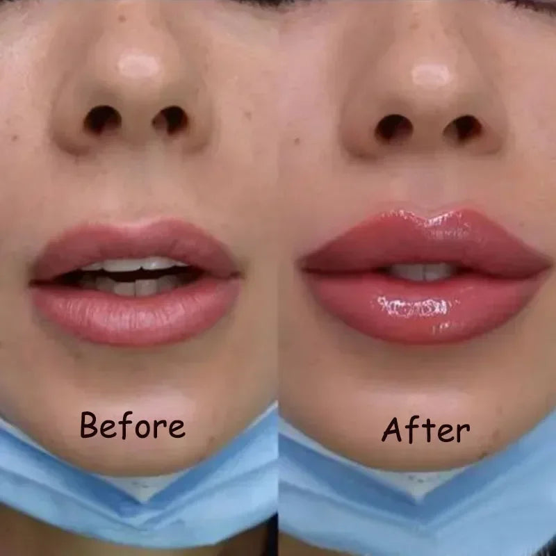 Lip Plump Serum Increase Lip Elasticity Reduce Fine Lines