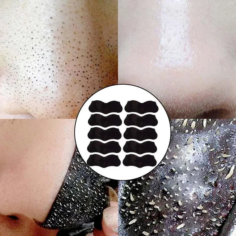 Nose Blackhead Remover Mask Deep Cleansing Shrink Pore Acne Treatment Mask